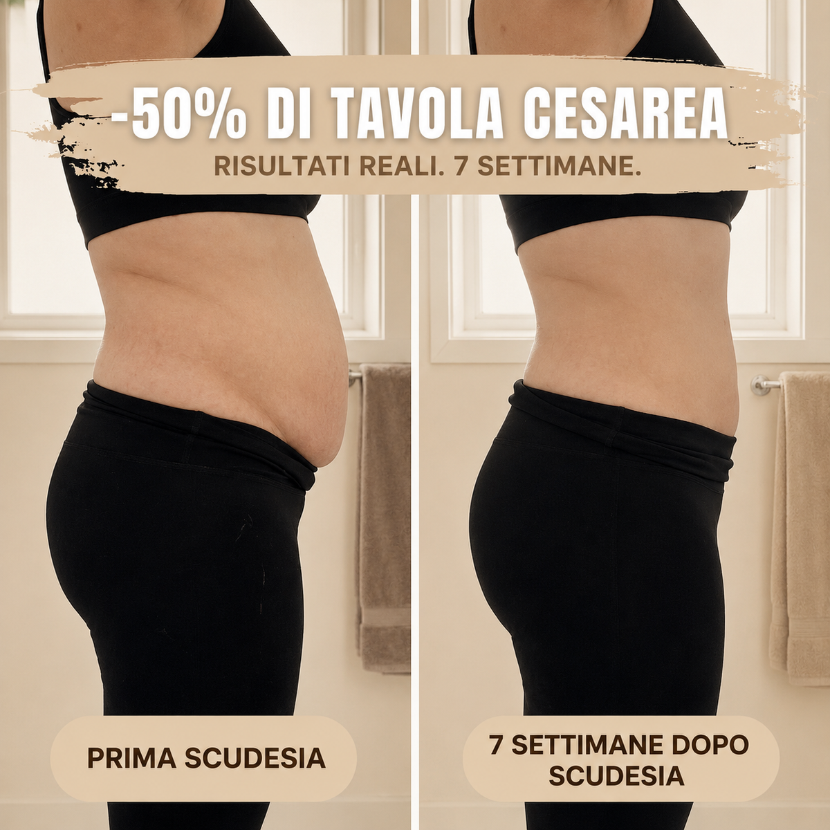 Mutandina Post-Parto — Compressione 360°