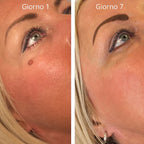 Nulevia Kit – Basta fibromi penduli