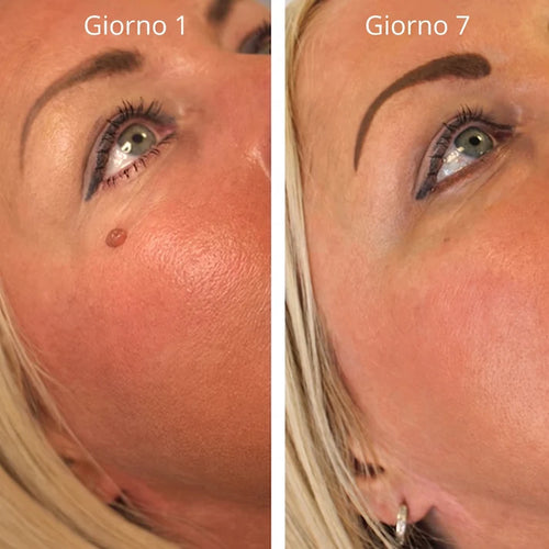 Nulevia Kit – Basta fibromi penduli