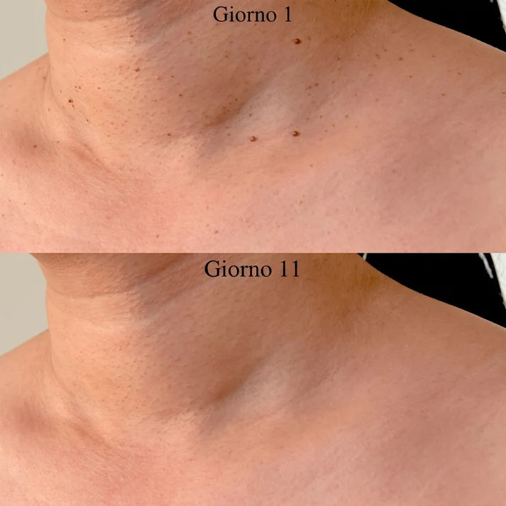 Nulevia Kit – Basta fibromi penduli