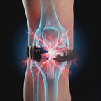 Fascia rotulea - Nulevia