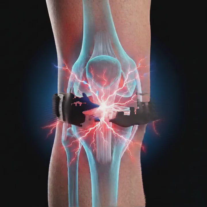 Fascia rotulea - Nulevia